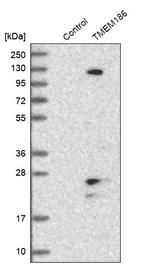 TMEM186 Antibody in Western Blot (WB)