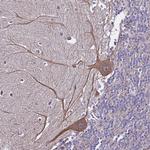 ZNF248 Antibody in Immunohistochemistry (Paraffin) (IHC (P))