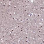 ZNF248 Antibody in Immunohistochemistry (Paraffin) (IHC (P))