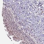 ZNF248 Antibody in Immunohistochemistry (Paraffin) (IHC (P))