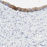CHAD Antibody in Immunohistochemistry (IHC)