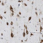 FXR1 Antibody in Immunohistochemistry (Paraffin) (IHC (P))