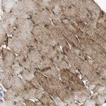 FXR1 Antibody in Immunohistochemistry (Paraffin) (IHC (P))