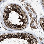 FXR1 Antibody in Immunohistochemistry (Paraffin) (IHC (P))