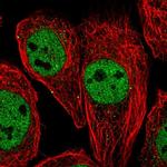 SMARCB1 Antibody in Immunocytochemistry (ICC/IF)