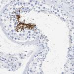 SPATA3 Antibody in Immunohistochemistry (IHC)