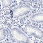 SPATA3 Antibody in Immunohistochemistry (IHC)