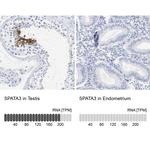 SPATA3 Antibody