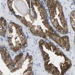 NDRG3 Antibody in Immunohistochemistry (Paraffin) (IHC (P))