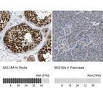 MIS18A Antibody in Immunohistochemistry (IHC)