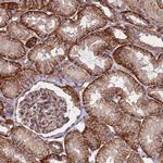 ZNF248 Polyclonal Antibody