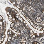 C21orf91 Polyclonal Antibody