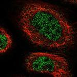 ZNF251 Polyclonal Antibody