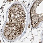 ZNF251 Antibody in Immunohistochemistry (Paraffin) (IHC (P))