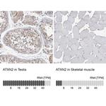 Ataxin 2 Antibody in Immunohistochemistry (IHC)