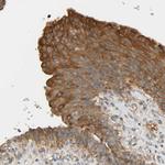 CEP57 Antibody in Immunohistochemistry (IHC)