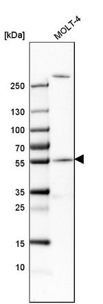 CEP57 Antibody in Western Blot (WB)