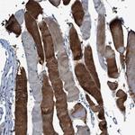 RWDD2B Polyclonal Antibody