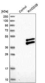 RWDD2B Antibody in Western Blot (WB)