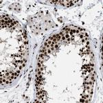 SFRS15 Antibody in Immunohistochemistry (IHC)