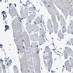 SFRS15 Antibody in Immunohistochemistry (IHC)