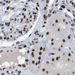 SFRS15 Antibody in Immunohistochemistry (IHC)