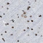 SFRS15 Antibody in Immunohistochemistry (IHC)