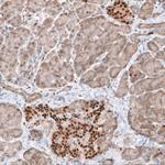 TOX Antibody in Immunohistochemistry (IHC)
