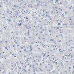 TOX Antibody in Immunohistochemistry (IHC)