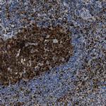 TOX Polyclonal Antibody