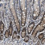 TOX Antibody in Immunohistochemistry (IHC)