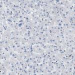 TOX Antibody in Immunohistochemistry (IHC)