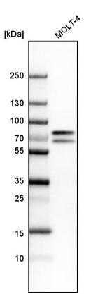 TOX Antibody in Western Blot (WB)