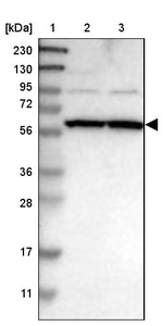 ZNF26 Antibody in Western Blot (WB)