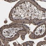 ZNF26 Antibody in Immunohistochemistry (IHC)