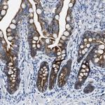 MRPL39 Polyclonal Antibody