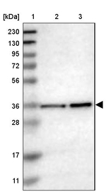 MRPL39 Antibody in Western Blot (WB)