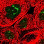 URB1 Polyclonal Antibody