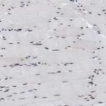 RBM8A Antibody in Immunohistochemistry (Paraffin) (IHC (P))