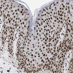 RBM8A Antibody in Immunohistochemistry (Paraffin) (IHC (P))