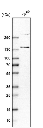 MORC3 Antibody in Western Blot (WB)