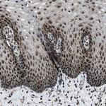 MORC3 Polyclonal Antibody