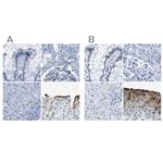 UPK3A Polyclonal Antibody