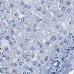 UPK3A Antibody in Immunohistochemistry (IHC)