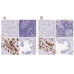 PAPPA2 Antibody in Immunohistochemistry (IHC)