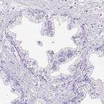 PAPPA2 Antibody in Immunohistochemistry (IHC)
