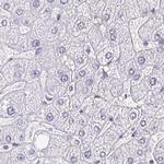 PAPPA2 Antibody in Immunohistochemistry (IHC)