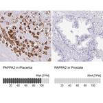 PAPPA2 Antibody
