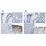 UPK3A Polyclonal Antibody