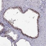 RTDR1 Antibody in Immunohistochemistry (Paraffin) (IHC (P))